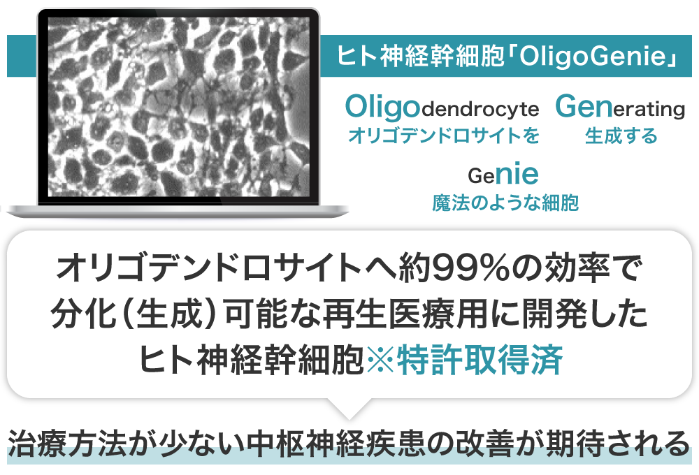 オリゴジェン社が開発したヒト神経幹細胞「オリゴジーニー」